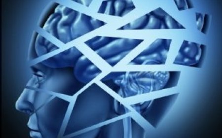 [PDF] Brain Damage by Freida McFadden Free Download